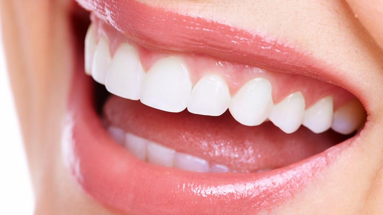 How to Straighten Your Teeth without Braces? What are the Other Options?