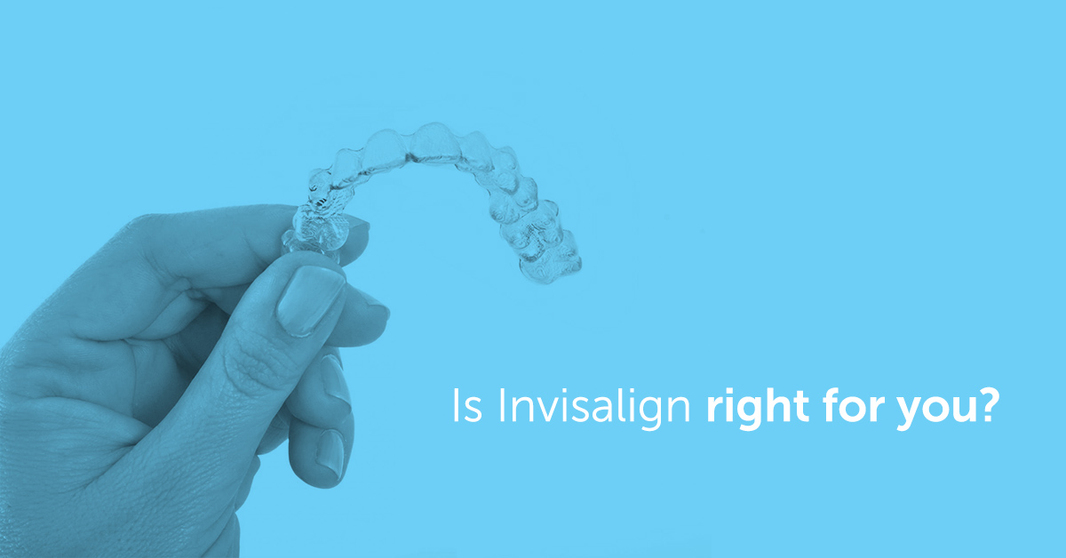 6 Hidden Facts of Invisalign Clear Aligners